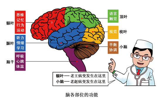 腦卒中發生在大腦各部位會影響人的哪些功能.視覺中國供圖